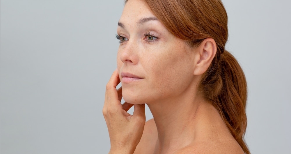 Model with freckles and sun spots touching her cheek