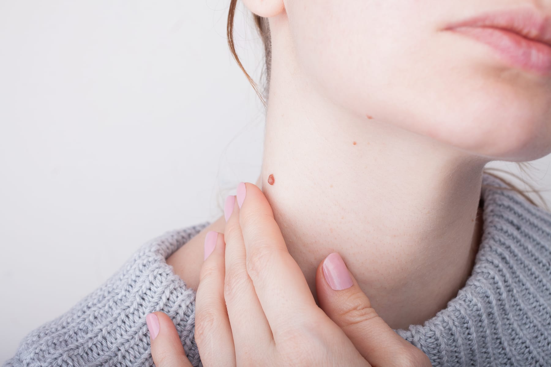 Model in a grey sweater touching small raised marks on the side of her neck