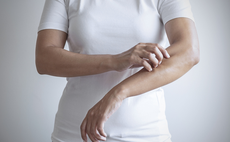 Person in a white T-shirt scratching an irritated forearm