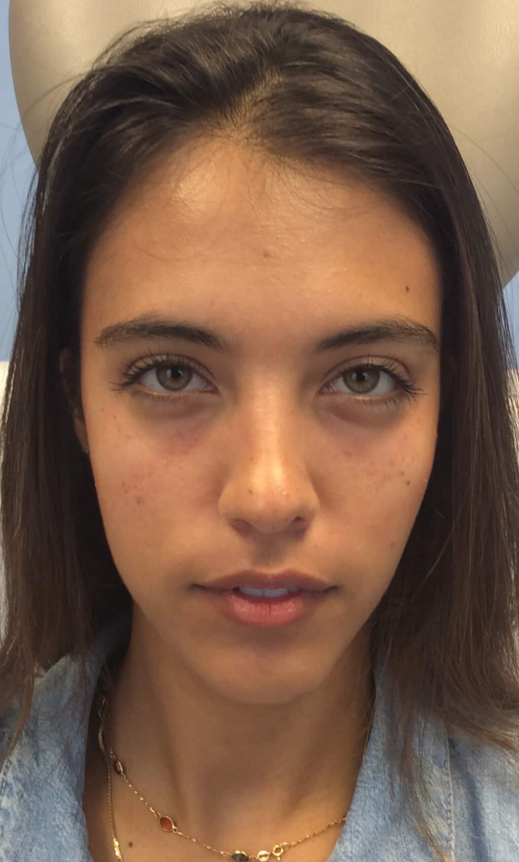 Before Image: Tear Through - front
