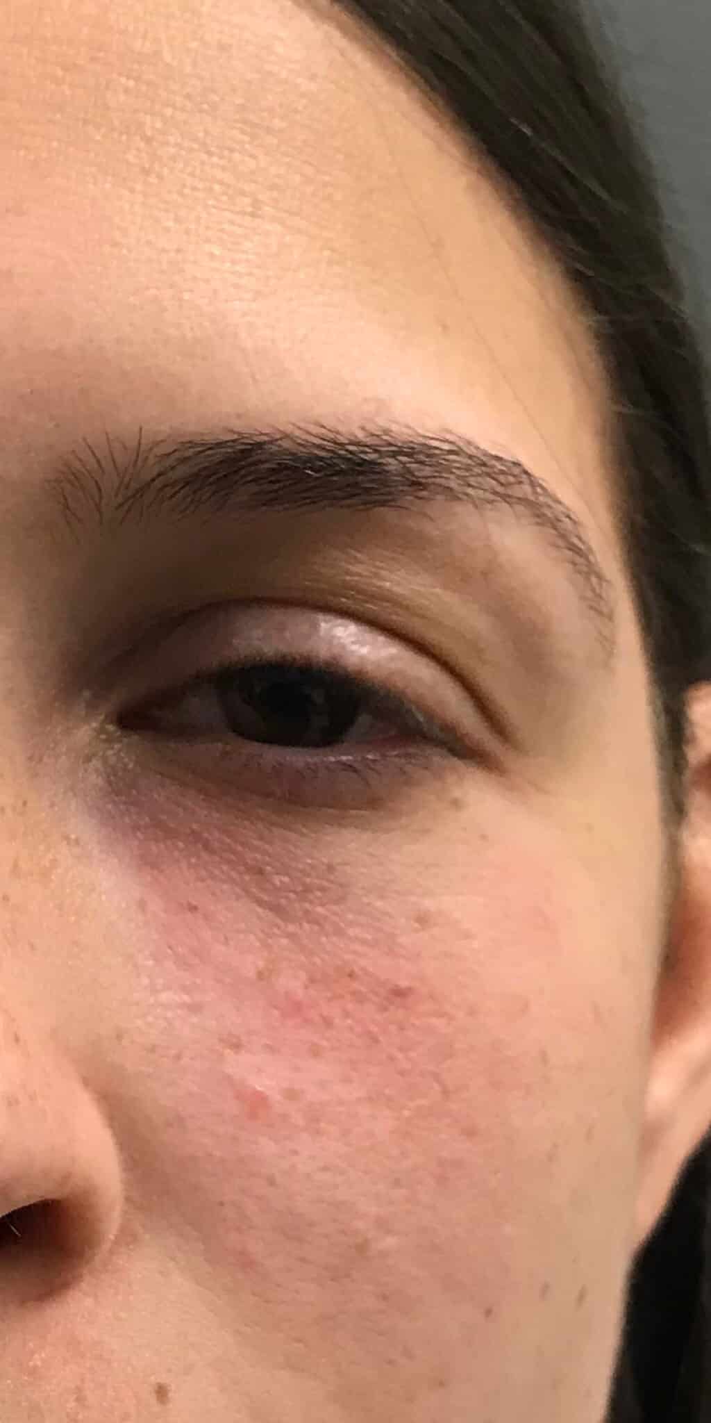 After Image: Tear Through - front