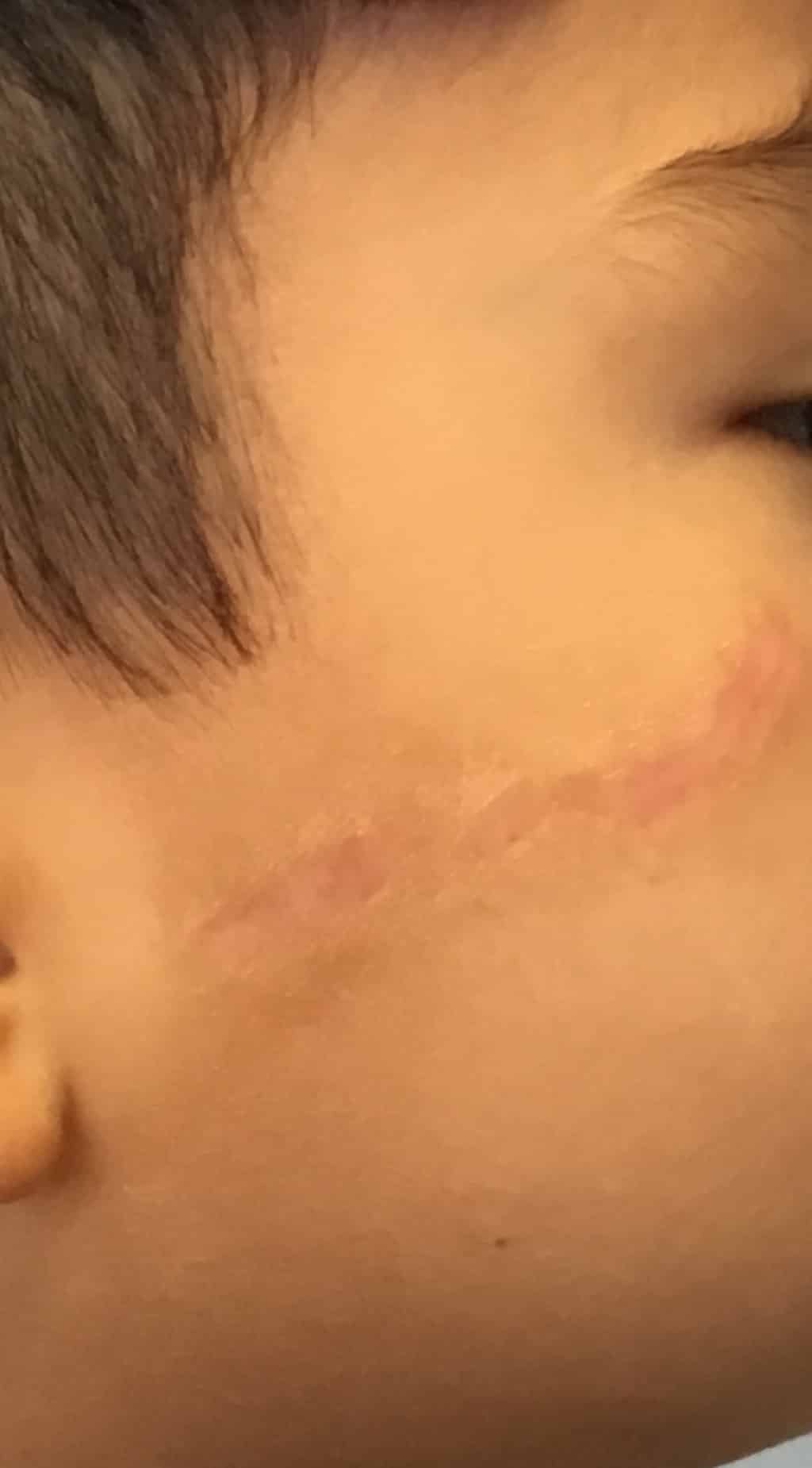 After Image: Scars - right-front-oblique