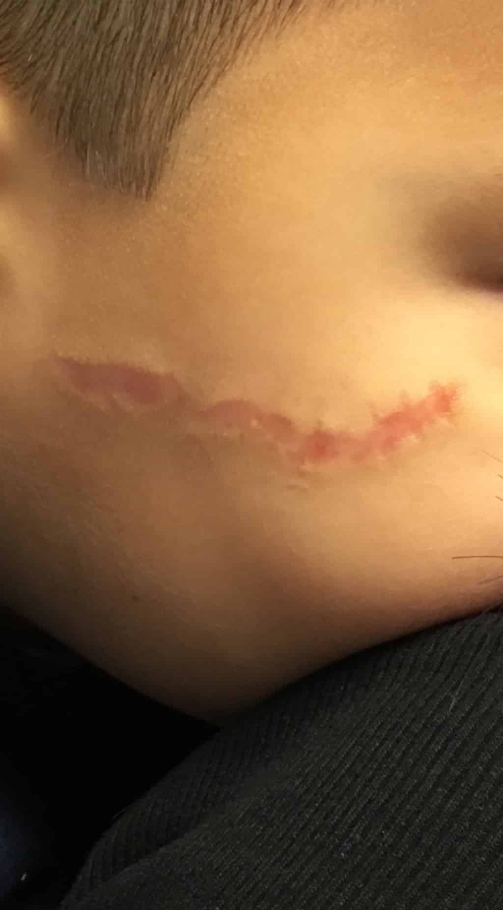 Before Image: Scars - right-front-oblique
