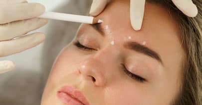 Clinician marking a model's forehead with white dots before an injection