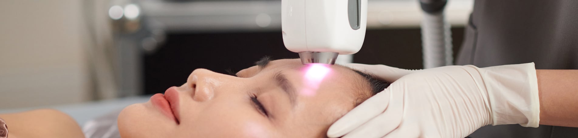Model lying back, eyes closed, as a gloved clinician moves a laser handpiece across her forehead
