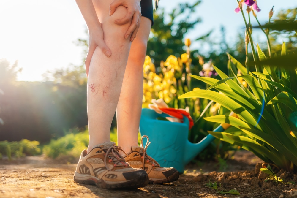 Close up of a woman clutching her leg in pain after her spider veins get irritated from a sunny, hot day.