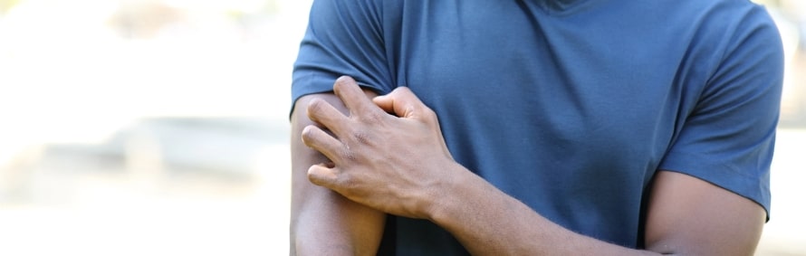 closeup of a man itching eczema on his arm