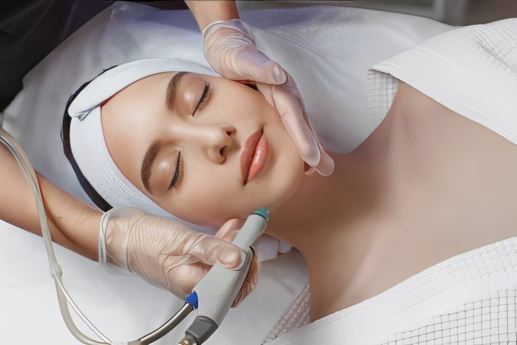 woman receiving microdermabrasion therapy on forehead at beauty spa