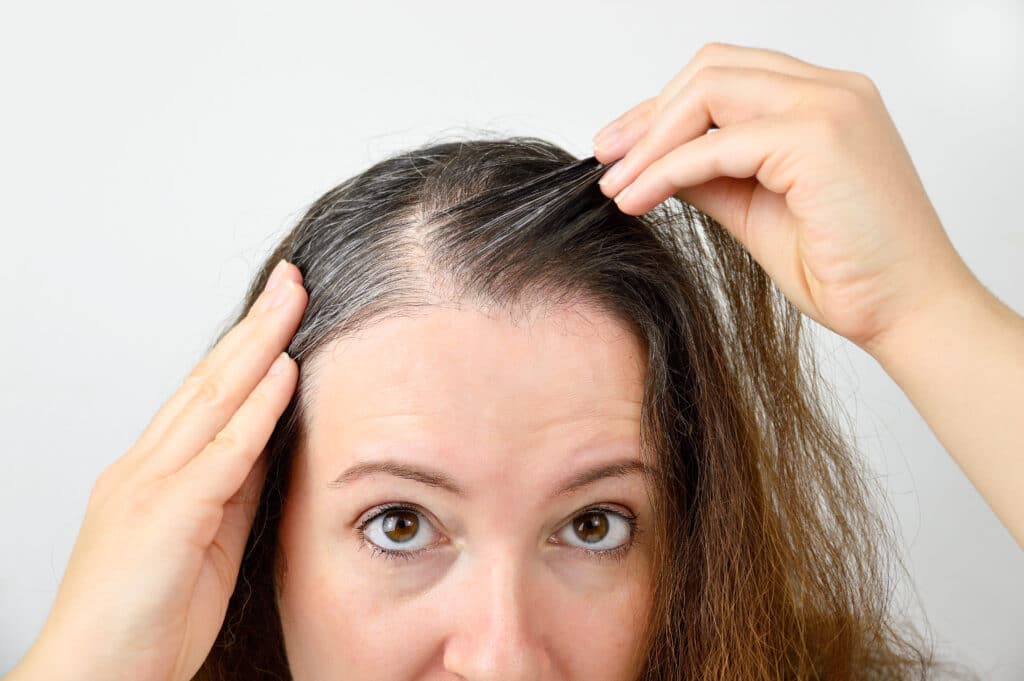 Close up of a woman looking at her scalp and suffering from alopecia hair loss, in need of treatment