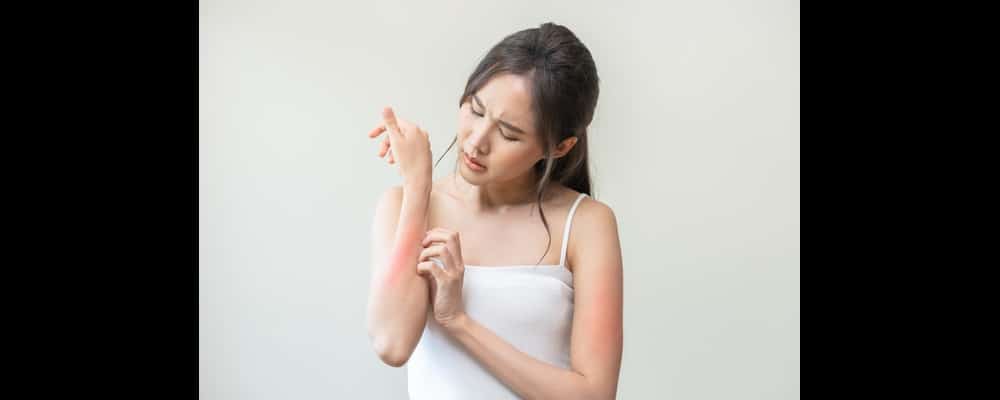 Woman scratching her itchy skin on her arms, with redness to show where her skin is irritated.